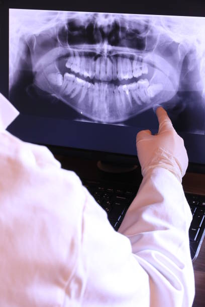 Best Emergency Treatment for Dental Infections or Abscesses in Seis Lagos, TX