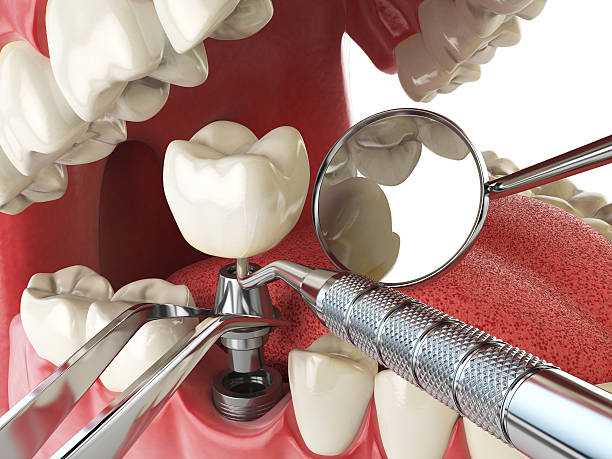 Best Emergency Gum Treatment in Seis Lagos, TX