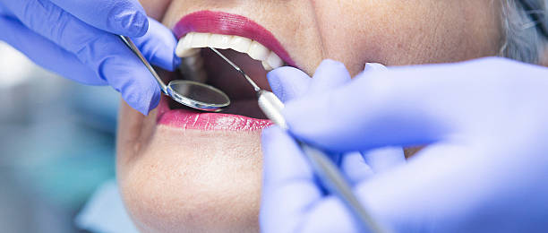 Best Emergency Treatment for Dental Infections or Abscesses in Seis Lagos, TX